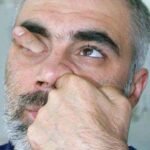 man-hand-nose-eye-finger-