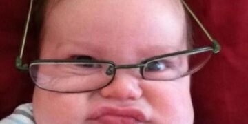 child-with-glasses-grimacing